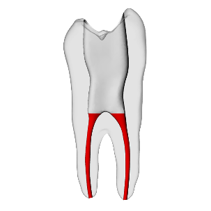 Premolar – Accessed, Basic, Clear, ~20# | Dental Training Models | DRSK – DRSK Group AB