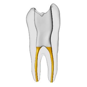 Premolar – Gutta percha, Clear | Dental Training Models | DRSK – DRSK Group AB, Gutta-Percha Points