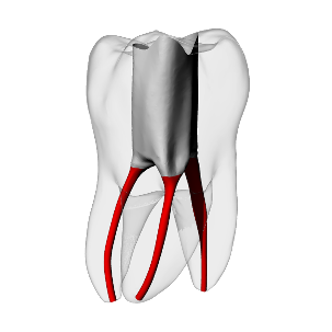 Molar – Accessed, Conductive Canals, Clear | Dental Training Models | DRSK