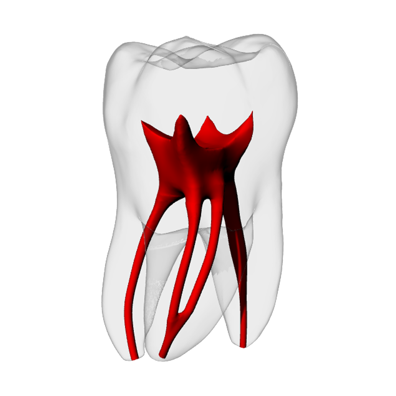 Molar – Merging MB2, Radiopaque (White) | Dental Training Models | DRSK