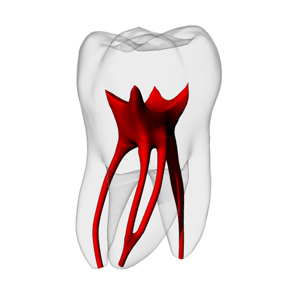 Molar – Merging MB2, Radiopaque (White) | Dental Training Models | DRSK