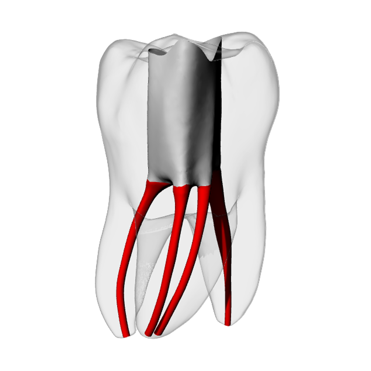 Molar – Accessed, MB2, Radiopaque (White) | Dental Training Models | DRSK