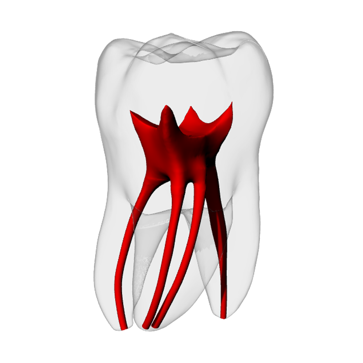 Molar – MB2, Radiopaque (White) | Dental Training Models | DRSK – DRSK Group AB, Demomodelle