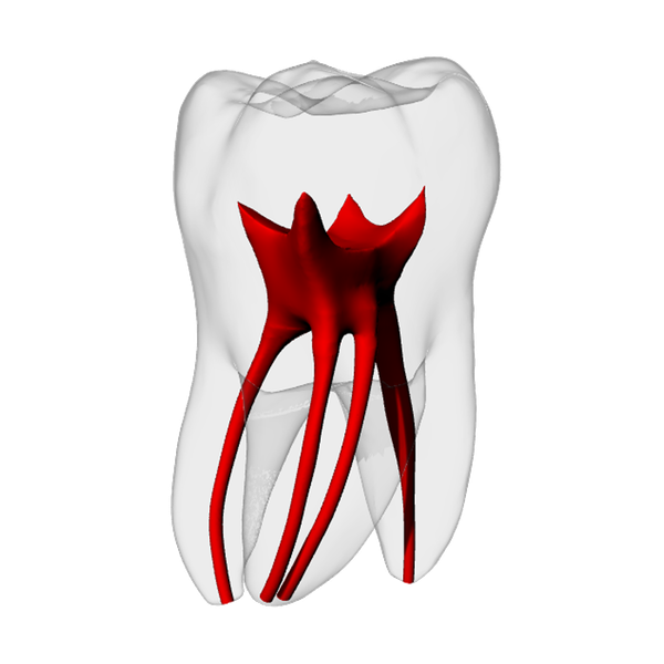 Molar – MB2, Radiopaque (White) | Dental Training Models | DRSK