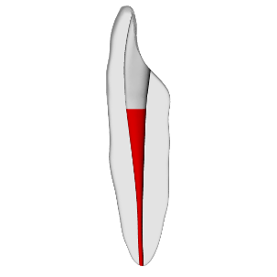 Incisor – Accessed, Conductive Canals, Clear | Dental Training Models | DRSK