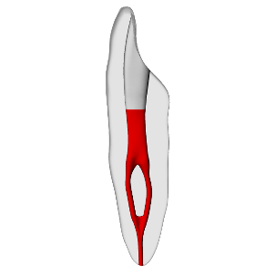 Incisor – Accessed, Merging canal, Clear, ~20# | Dental Training Models | DRSK