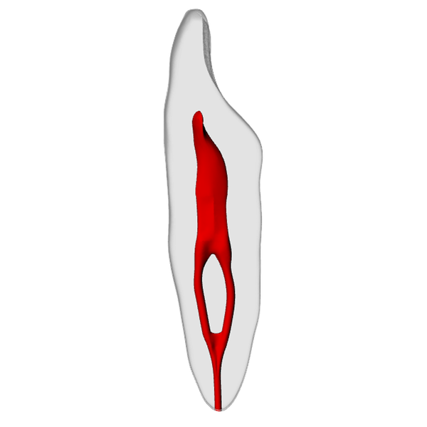 Incisor – Merging canal, Clear Root, White Crown, ~20# | Dental Training Models | DRSK