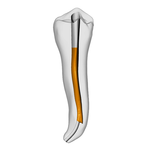 Premolar – Gutta percha, Ledge | Dental Training Models | DRSK