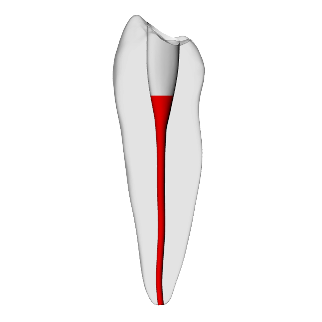Premolar – Accessed, Basic, Clear, ~20# | Dental Training Models | DRSK – DRSK Group AB, Die & Model Materials