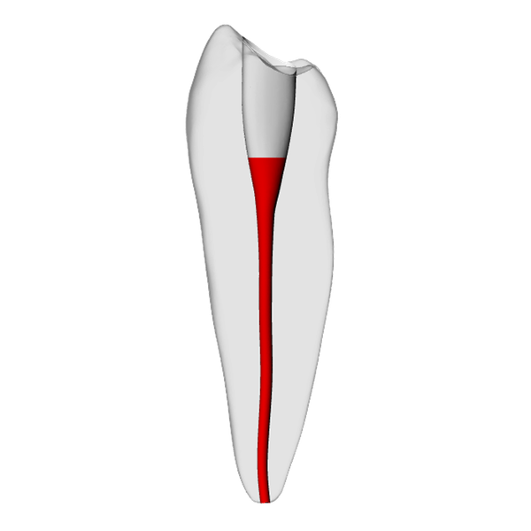 Premolar – Accessed, Basic, Clear, ~20# | Dental Training Models | DRSK