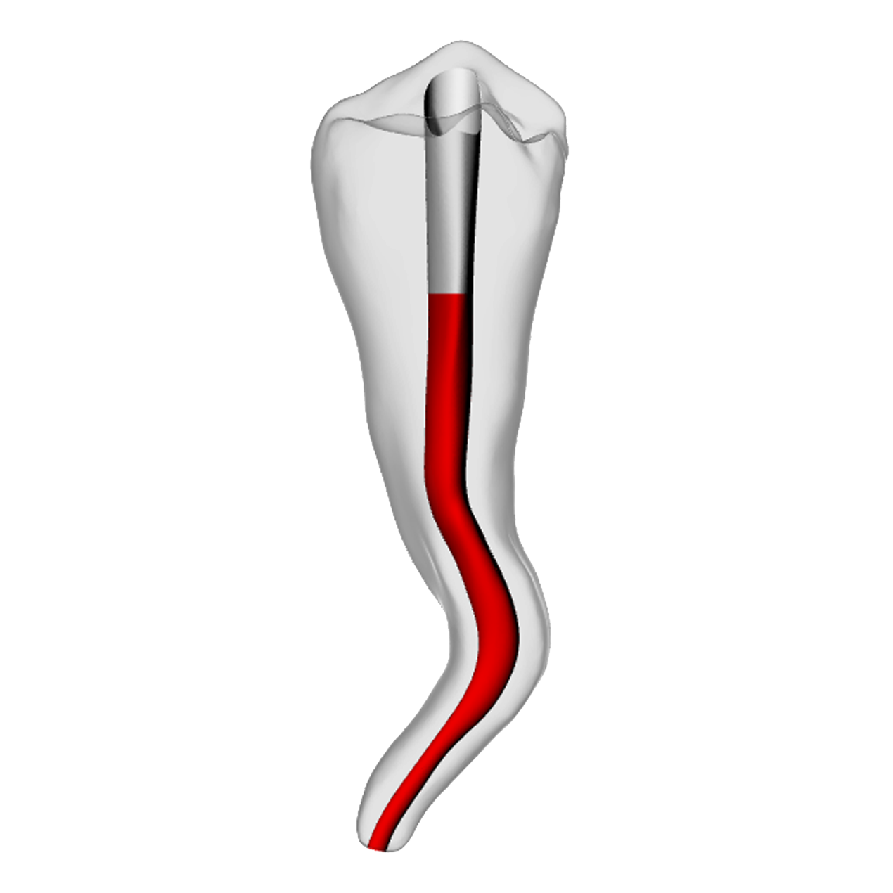 Premolar – Accessed, Dilacerated, Radiopaque (White) | Dental Training Models | DRSK