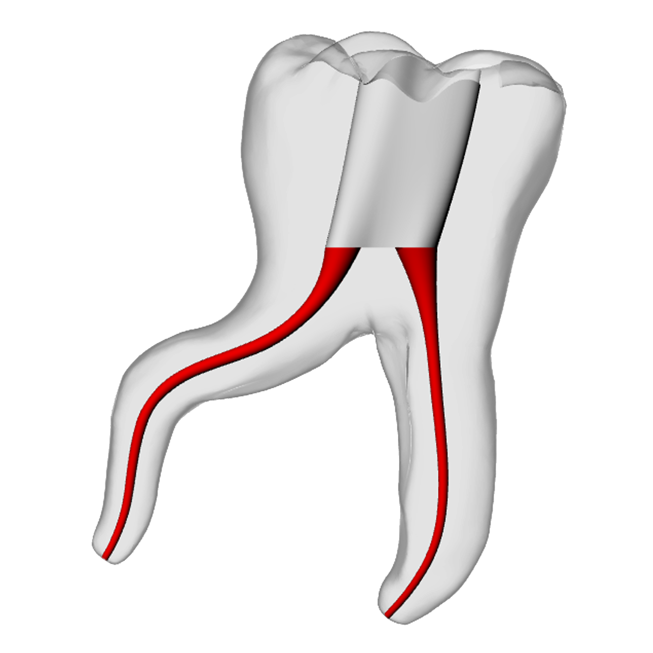 Molar – Severe Curvature 1, Clear | Dental Training Models | DRSK