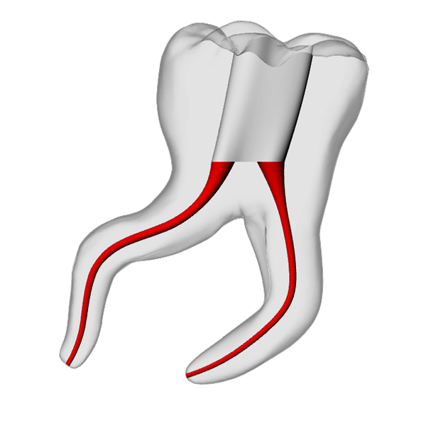 Molar – Severe Curvature 2, Clear | Dental Training Models | DRSK