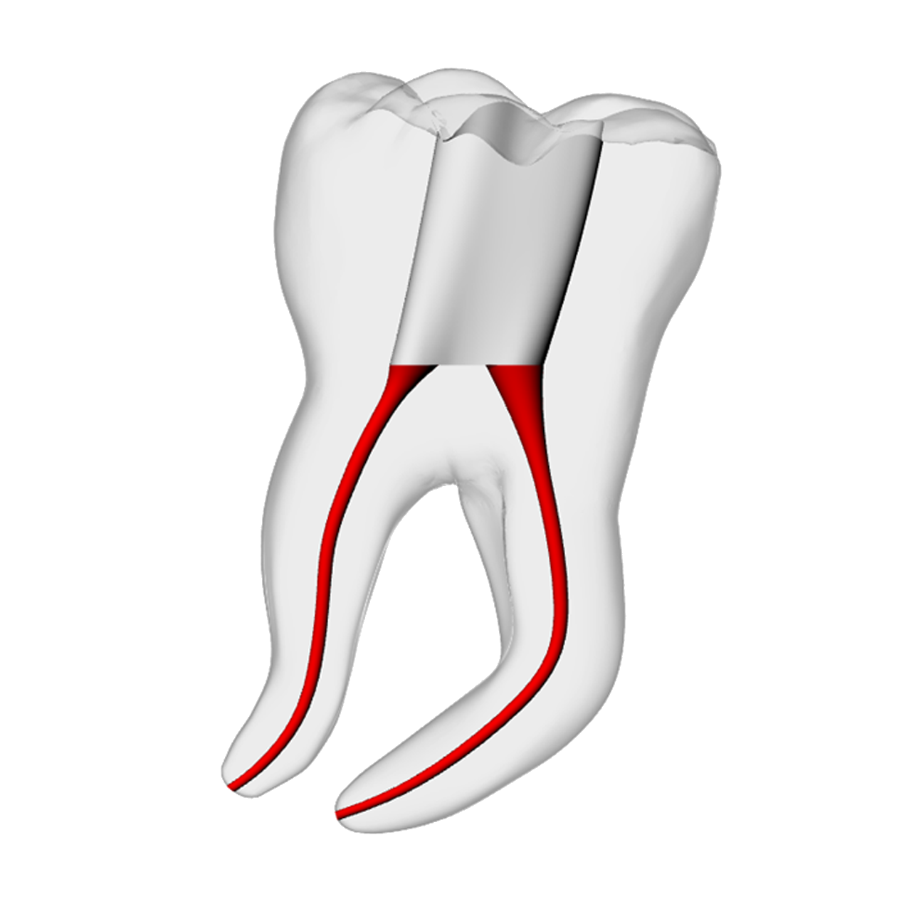 Molar – Severe Curvature 3, Clear | Dental Training Models | DRSK