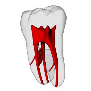 Molar – Accessory canals | Dental Training Models | DRSK