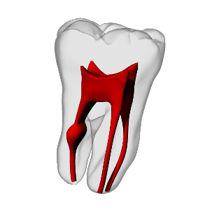 TEC2-Endodontie – DRSK Group AB, Demonstration Models