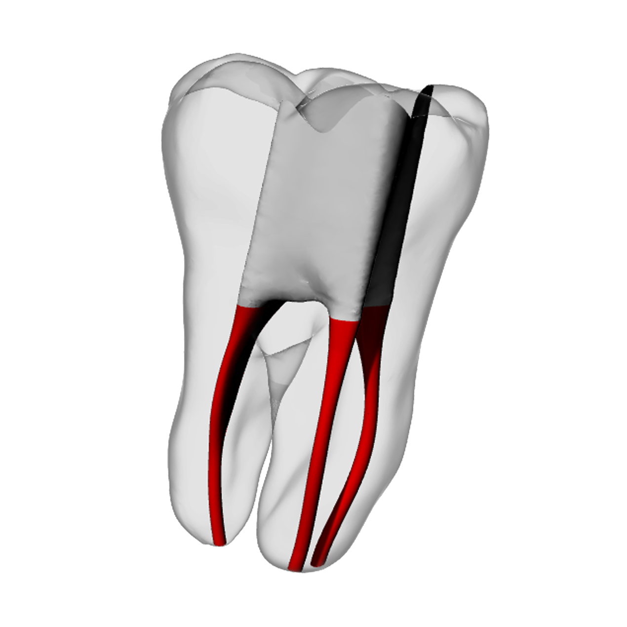 Molar – Accessed, Conductive Canals, Clear | Dental Training Models | DRSK