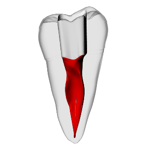 Second molar – C-Shape | Dental Training Models | DRSK