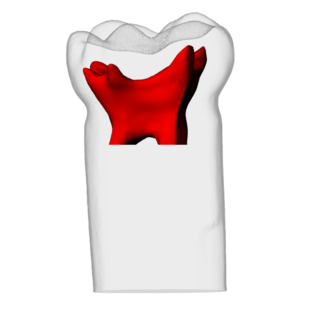 Primary maxillary second molar – DRSK Group AB, Laboratory Equipment