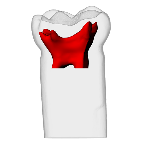 Primary mandibular second molar