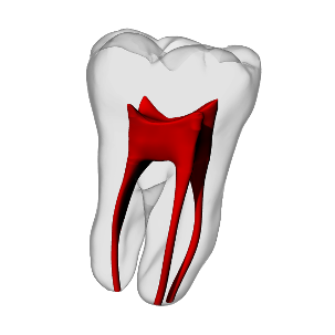 Molar – Basic, Clear Root, White Crown | Dental Training Models | DRSK