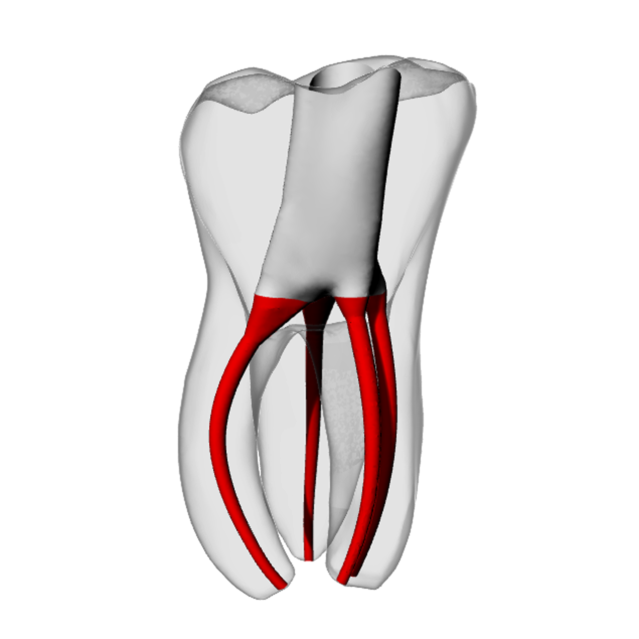 Molar – Accessed, MB2, Moderate Curvature | Dental Training Models | DRSK