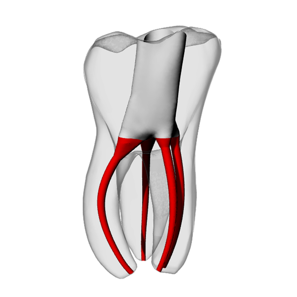 Molar – Accessed, MB2, Moderate Curvature | Dental Training Models | DRSK