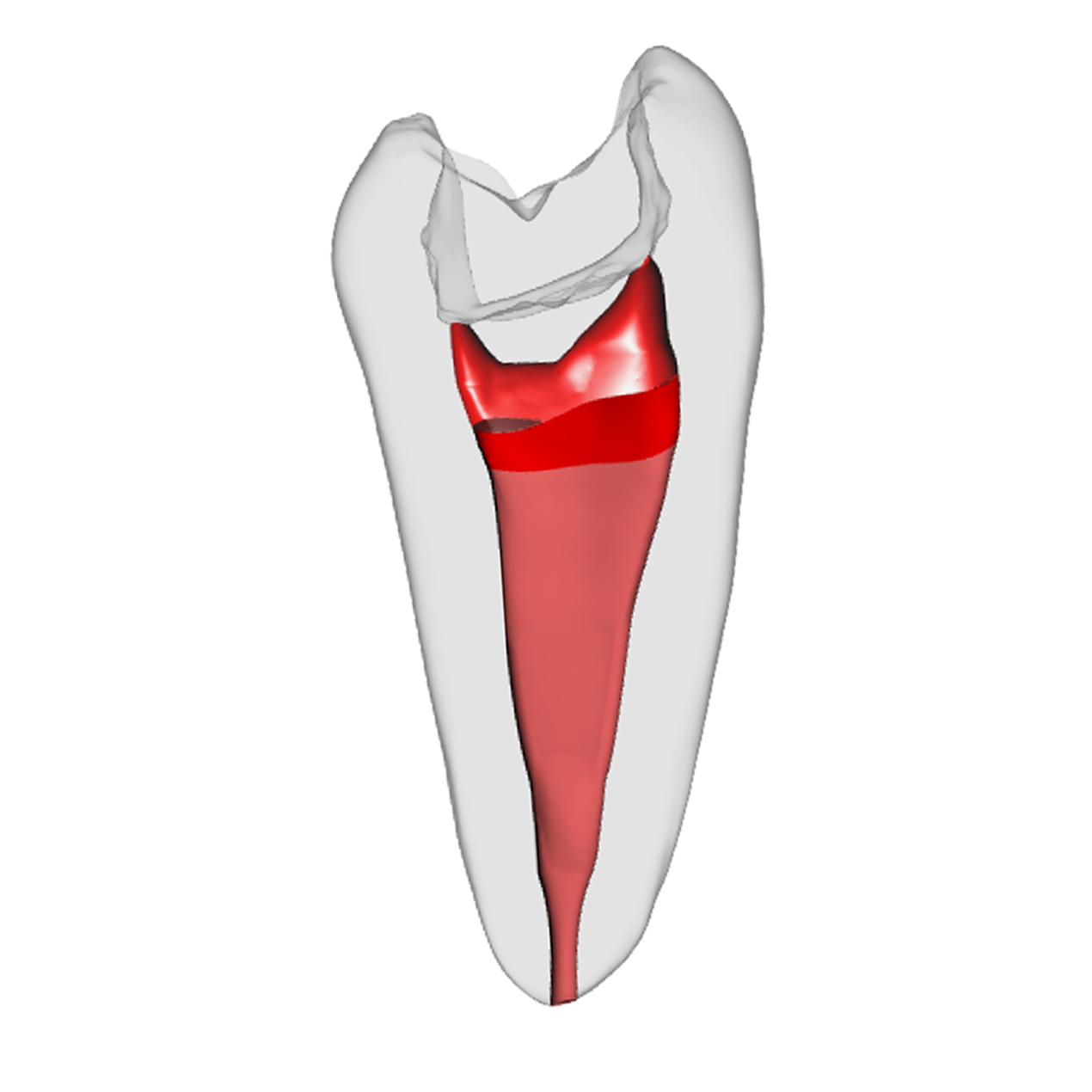 Prämolar - Vitalpulpatherapie, Weiß