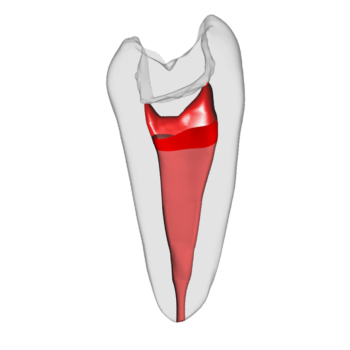 Prämolar - Vitalpulpatherapie, Weiß – DRSK Group AB, Demomodelle