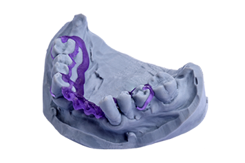 Dental Cast