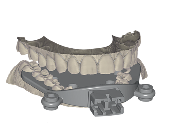 Jaw Motion Import Module