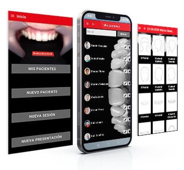 Fotodental Smartphone-App – FOTODENTAL, CAD/CAM-Software