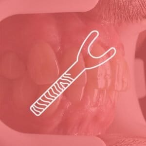 Lippenretraktoren – FOTODENTAL, Pinzetten