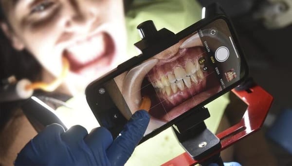 Fotodental Smartphone-Beleuchtungsgerät