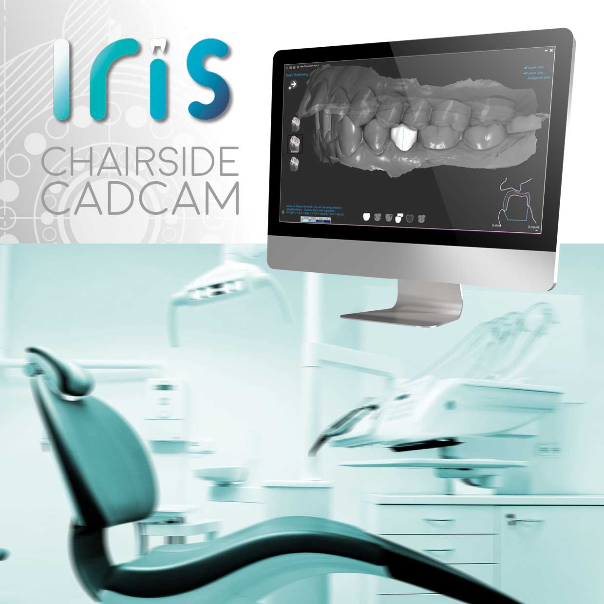 Iris Chairside CADCAM