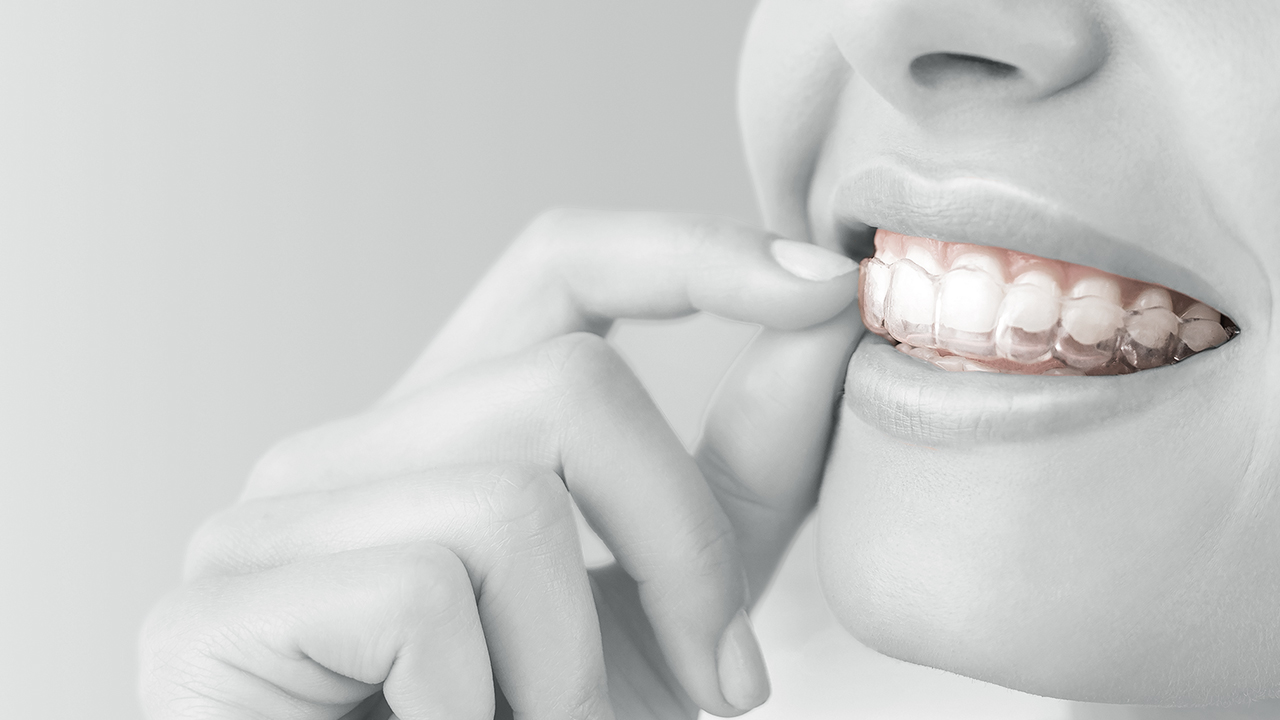 GT FLEX Clear Aligner & Retainer Material