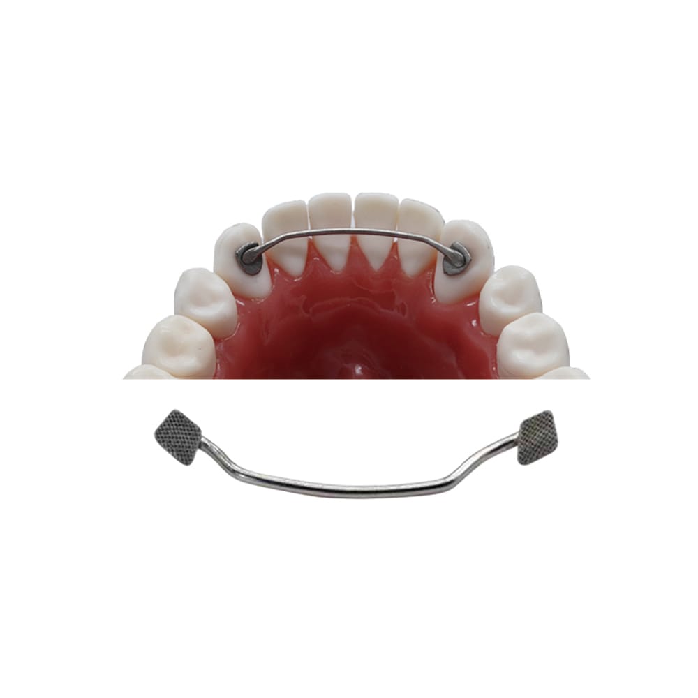 Bondable Lingual Retainer BLR – Sino Ortho Limited, Retention