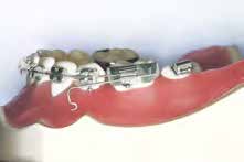 OrthoEasy Lab Analog