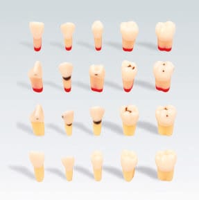 AG-3 KH AE Abrasionsmodell