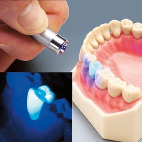 AG-3 ZEF Modellzähne aus fluoreszierendem Material für Prüfungen