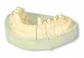 Mirapont 1000g