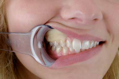 Reso-Pac 25g – Hager Werken, Other Surgical & Implant Products