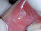 mirafluor-gel strawberry