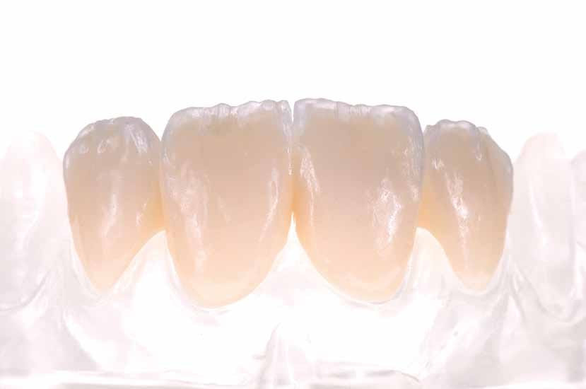 NyloBrush #2 – HPdent GmbH, Dental Laboratory Instruments