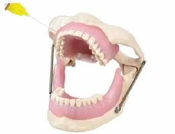 Anesthesia Practise Jaw Model