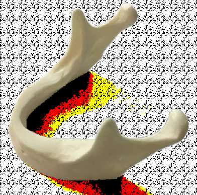 Anatomical Shape Simple Mandible – Navadha Enterprises, Implant Patient Education Materials