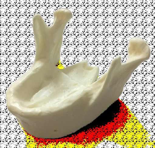 Mandible Model for Implant Training