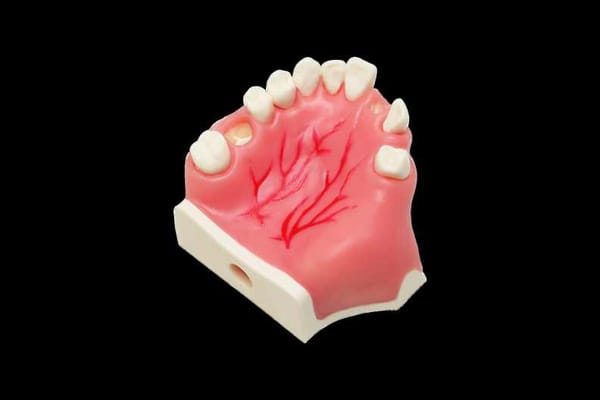 Model for Implant Placement with Sinus Septa