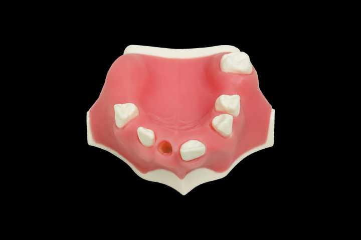 Modèle pour Pose Implantaire Immédiate avec Structure Osseuse Spongieuse – Navadha Enterprises, Implantology