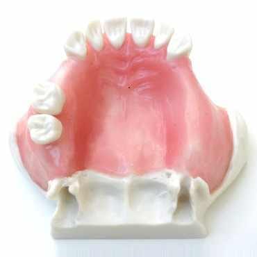 Sinus Lift with Soft Gingiva Model